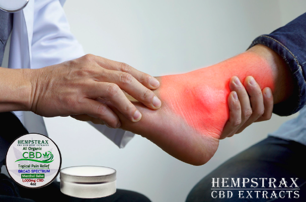 Image of ankle pain and text of using CBD for fighting Gout with CBD salve
